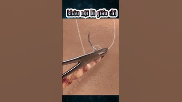 Khâu nội bì giấu chỉ y học #thegioithuvi #bietthemmotchut