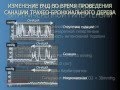 Коррекция внутричерепной гипертензии при ЧМТ