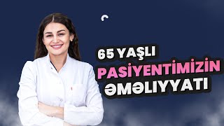 Dr. Gülanə Ağayeva - Angioplastika