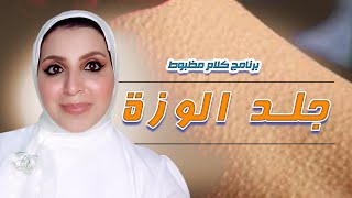 ارخص واغلي علاج لجلد الوزه واسبابه 