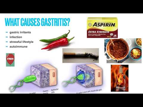 Video: Erosive Gastritis - Symptoms, Diet And Treatment