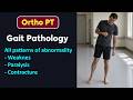 Gait Pathology Ortho PT 