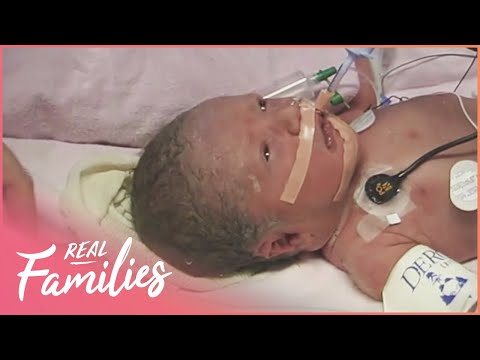 LITTLE MIRACLES - STABILISING PREMATURE BABY WITH BREATHING TROUBLES