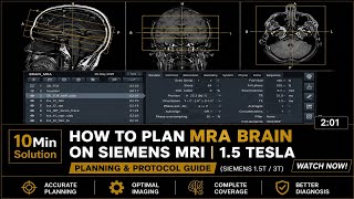 How to Plan MRA Brain on Siemens MRI | 1.5 Tesla vs 3 Tesla Comparison