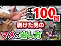 【この道のプロです】手の皮を最速で治すには!?