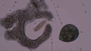 Vizelet protozoa