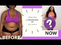 REVEALING MY NEW BODY AFTER WEIGHT LOSS SURGERY: Loose skin, Scars & MORE!! 6 months post op (VSG)