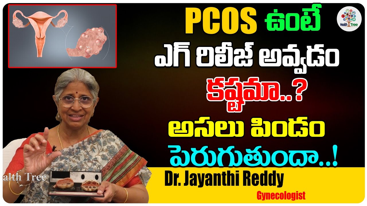 PCOS ఉంటే ఎగ్ రిలీజ్ అవ్వడం కష్టమా...? | PCOS | PCOD | Dr. Jayanthi ...