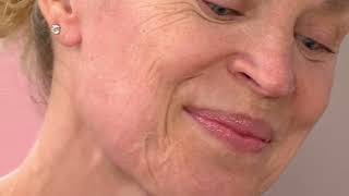 DERMAFLASH LUXE Anti-Aging Exfoliation Auto-Delivery on QVC