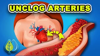 top 7 natural ways to unclog arteries | clean your arteries & prevent heart attack