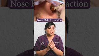 Best Dermatologist in Delhi reacts to Nose Hair Waxing | Nose Hair Removal | #shorts #nosehair