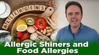 Allergic Shiners and Food Allergies | Dr. J Q & A