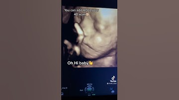 HD for your 4D Scan🤩 #hd #4d