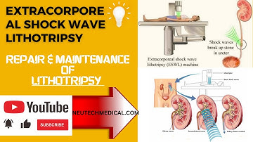 What is Lithotripsy| Extracorporeal Shock Wave Lithotripsy| procedure of  Shockwave Lithotripsy