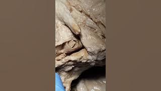 Lab #11:  The Female Reproductive Tract (part 1)
