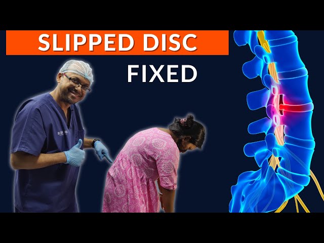 Chiroページ RECOVERY of SLIPPED DISC | Best Chiropractor in INDIA | Dr Sanjay
