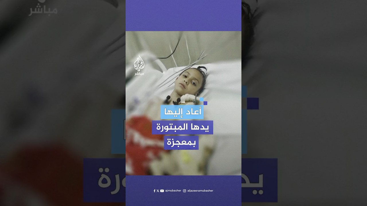 "أشبه بالمعجزة".. قصة طبيب عراقي أعاد يدا مبتورة إلى جسد طفلة فلسطينية في غزة