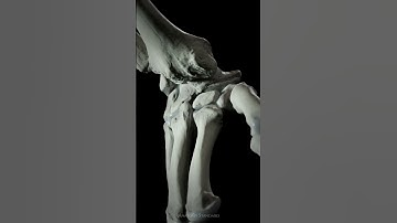 Capitate centered diagonal movement of the wrist