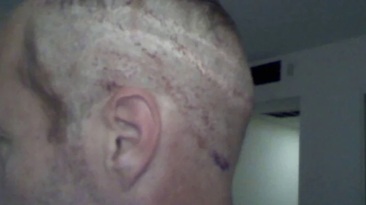 My Terrible experience with dr alan bauman  My nam...