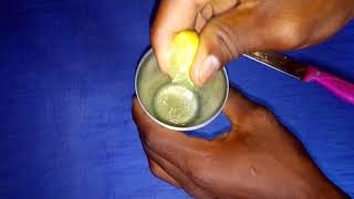 Dawahii inatibu Vipele,Chunusi,Utangatanga Na Magonjwa Mengine ya Ngozi. Dawahii inatibu Vipele,Chunusi,Utangatanga Na Magonjwa Mengine ya Ngozi.