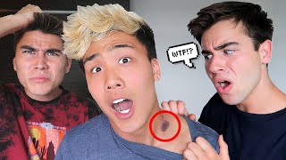 Hickey Prank On My Bestfriends!