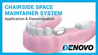 Pediatric Chairside Space Maintainer system — Application & demonstration