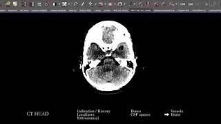 [CT] Head | Search Pattern