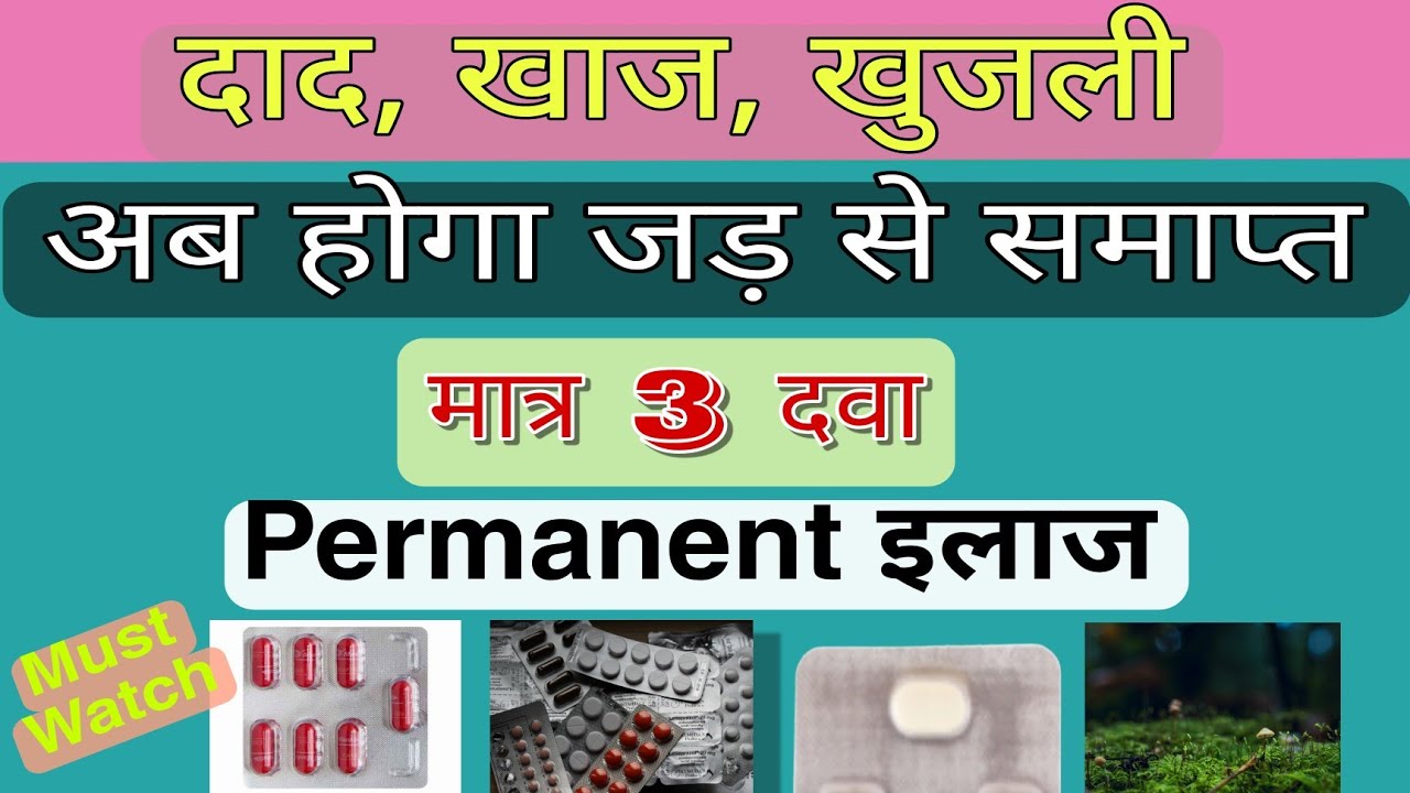 पुराने से पुराने दाद,खाज, खुजली जड़ से समाप्त करे Ringworm, fungal