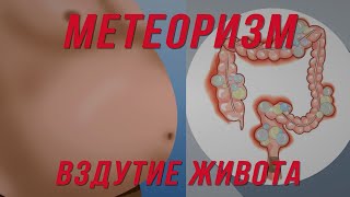 Метеоризм.  Вздутие живота.  Схема лечения.