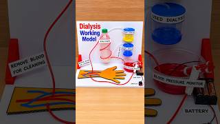 dialysis working model - shorts - biology project - craftpiller