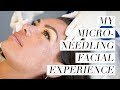 My Microneedling Facial Experience