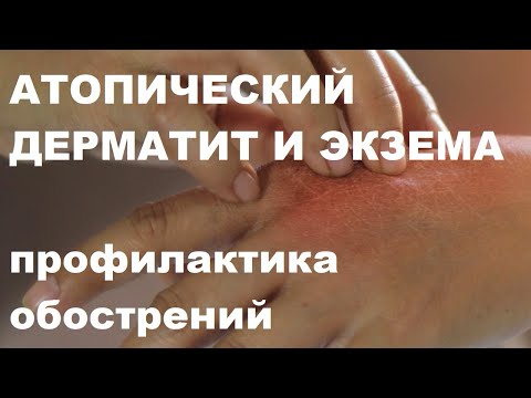 Эллинский Д.О. Атопический дерматит и экзема у взрослых: профилактика обострений. 23.09.2022