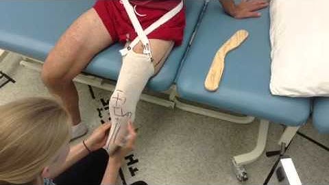 Transtibial Landmarks
