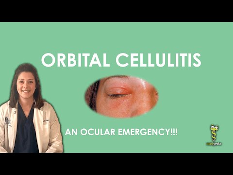 Video: Orbital Cellulitis: Symptomer, årsaker Og Behandlinger
