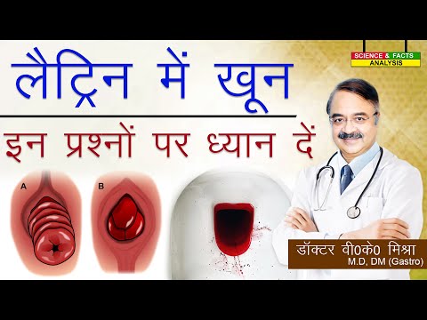 वीडियो: एक न्यूरोलॉजिस्ट कैसे खोजें: आपके सबसे महत्वपूर्ण प्रश्नों का उत्तर दिया गया