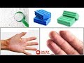               home remedies for hands allergy