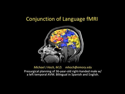 Vídeo: Un Conjunto De Datos FMRI Test-retest Para Funciones Motoras, De Lenguaje Y De Atención Espacial