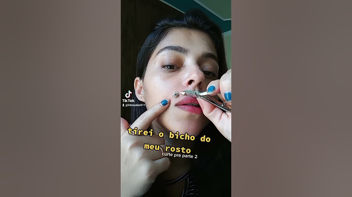 'ATUAÇÃO' TIREI O BICHO DE PE DO ROSTO. #shorts  #short contém ironia