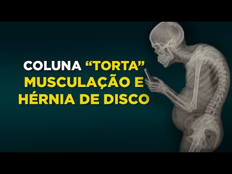 Você Esta Sabotando Sua Coluna na Academia (Mesmo Fazendo os Exercícios Certos)