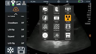 Bladder Volume Measurement for Android