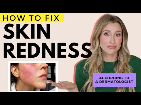 Fix Redness on