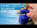 Chin filler tutorial  the best techniques