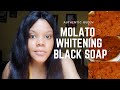 Molato Whitening Black Soap... Skin Whitening Soap.Very Effective👌