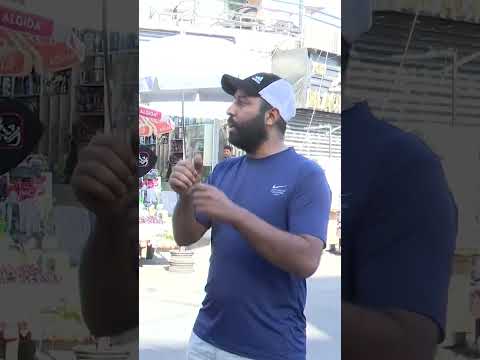 شاب يروي قصته مع بتر أصبعه اصبعي شايلة بأيدي