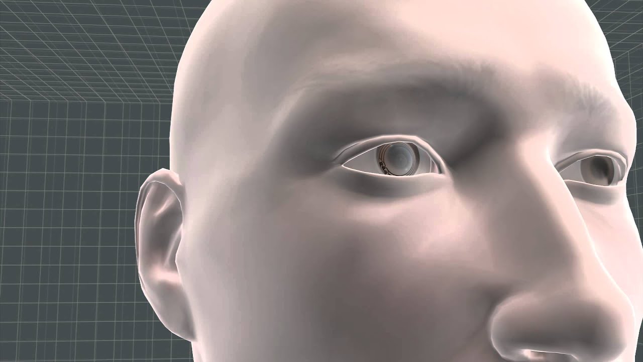 Google contact lens monitors glucose in tears