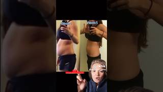 Before and After - Real life examples of Hormonal Belly ?