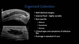 US for Extremity and Soft Tissue Infections screenshot 3