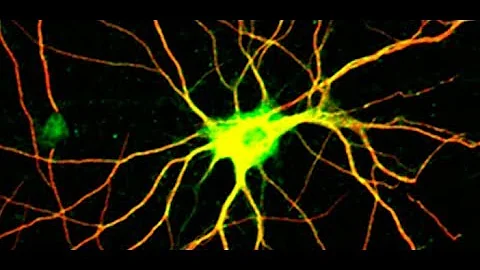 The role of VTA dopamine neurons in depression