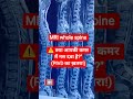⚠️ क्या आपकी कमर में नस दबा है?"(PIVD का ख़तरा!)#shortsfeed#trending#physiotherapist#medical#world