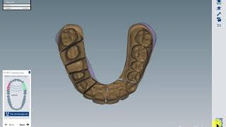 Ceramill Mind Introduction of new GUI